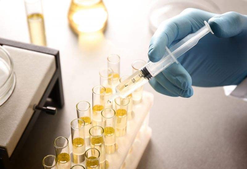 尿檢能檢測(cè)出來(lái)什么問(wèn)題？