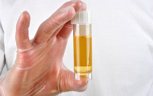 尿檢能檢測(cè)出來(lái)什么問(wèn)題？