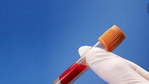 健康體檢一般檢查哪些項(xiàng)目？